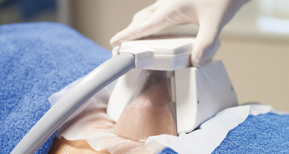 How Fat Freezing and HIFU Work Together? 2 Multiple Areas in One Session HIFU and Fat Freezing Godalming