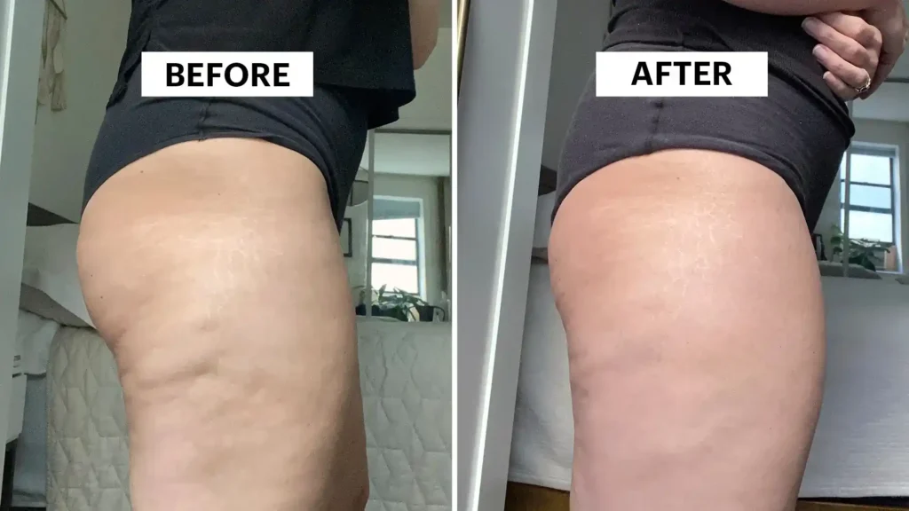 Do Toning Exercise Godalming Really Tackle Cellulite?
