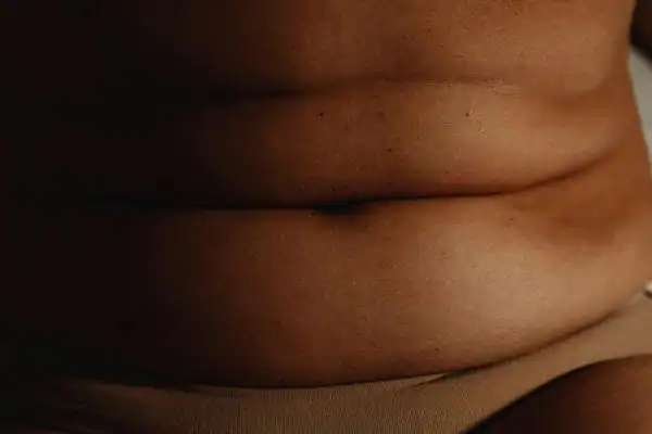 The Hidden Connection: How Stress Shapes Your Fitness and Body Composition 3 image of what stress can do on the stomach area and how Lipo 360 Godalming can help to change your body shape.