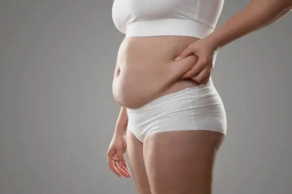 Image of stress belly Godalming How Lipo 360 can help manage your symptoms
